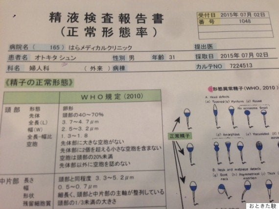 不妊治療1回あたりの成功率は 39歳で10 43歳ではなんと2 以下 ハフポスト