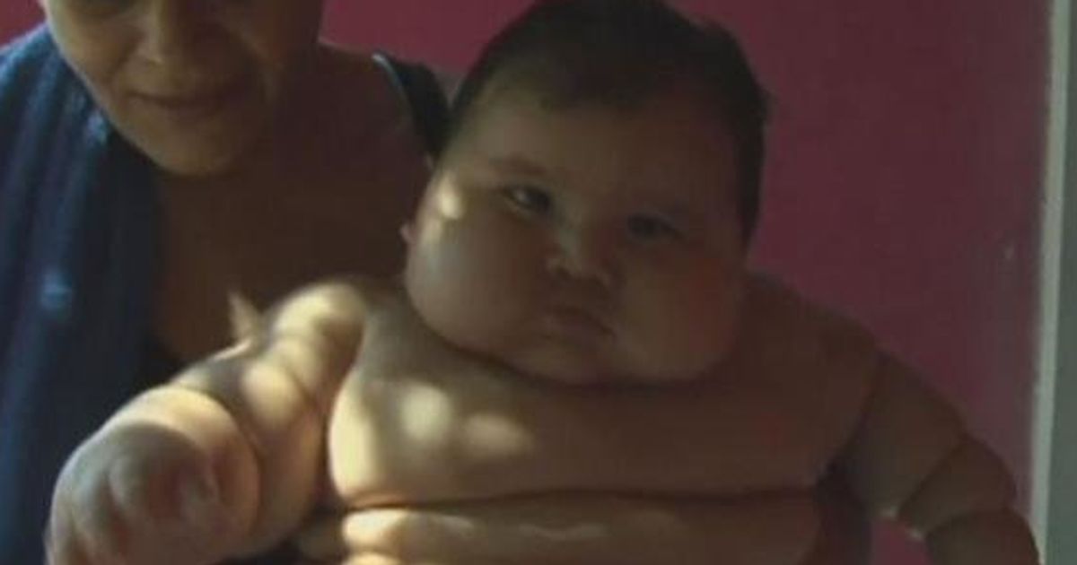 コロンビアで体重キロの メタボ赤ちゃん 医師団のもとで減量へ ハフポスト