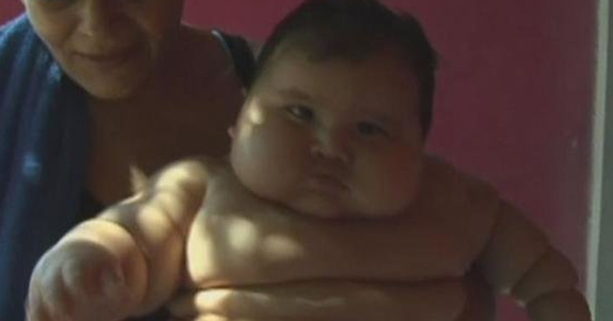 コロンビアで体重キロの メタボ赤ちゃん 医師団のもとで減量へ ハフポスト コロンビアで体重キロの メタボ赤ちゃん 医師団のもとで減量へ ハフポスト