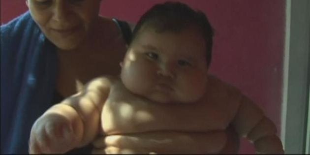 コロンビアで体重20キロの「メタボ赤ちゃん」