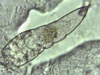 あなたの顔にも ニキビダニ が寄生している 研究結果 ハフポスト Life あなたの顔にも ニキビダニ が寄生している 研究結果 ハフポスト Life