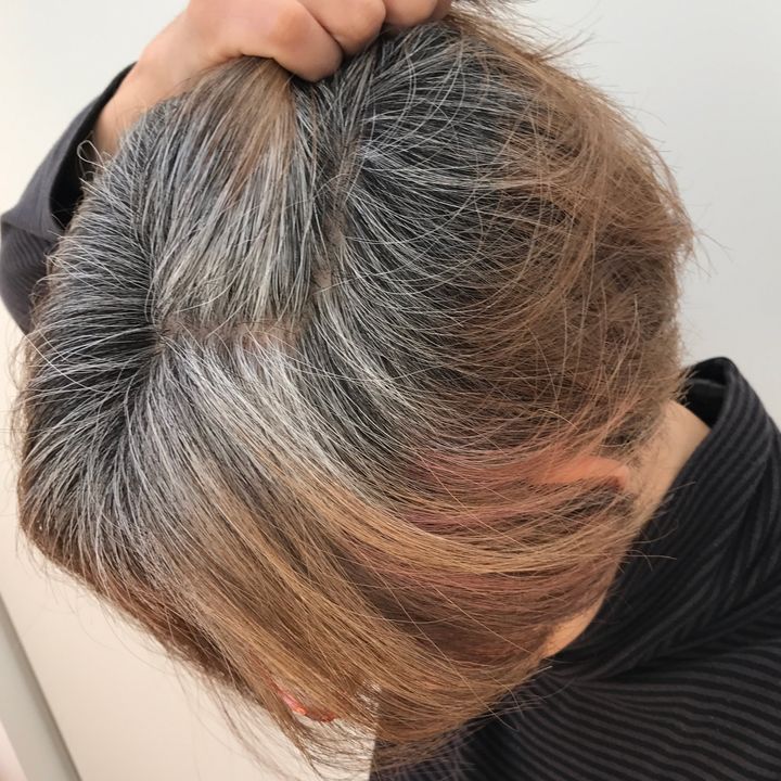 白髪育てスタートから３カ月が過ぎたころの朝倉真弓さんの髪