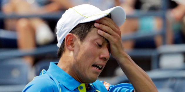 Kei Nishikori, of Japan, reacts after losing a point to Benoit Paire, of France, during the first round of the U.S. Open tennis tournament, Monday, Aug. 31, 2015, in New York. (AP Photo/Charles Krupa)