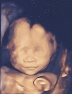 妊娠22週のエコー写真。妊娠前から、女の子で「あかねちゃん」と名付けると決めていたのだけど、男の子ということが判明！男の子を育てられるのか、不安になりました、笑。