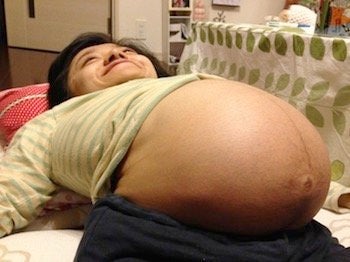 妊婦 おへそ