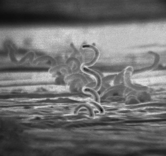 梅毒トレポネーマ（電子顕微鏡写真） CDC / Dr. David Cox