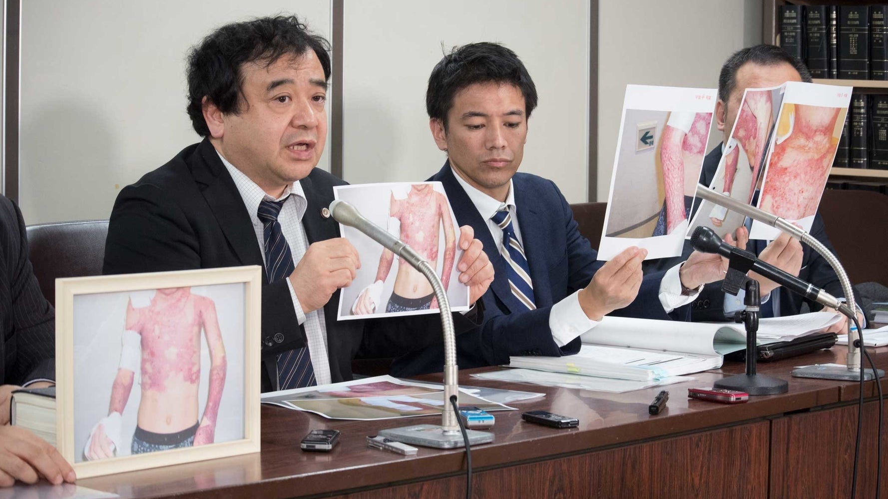 元外国人実習生が火だるまに 異常な事件の中で起きた さらに あり得ない 事態 ハフポスト 元外国人実習生が火だるまに 異常な事件の中で起きた さらに あり得ない 事態 ハフポスト