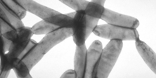 レジオネラ菌のイメージ写真