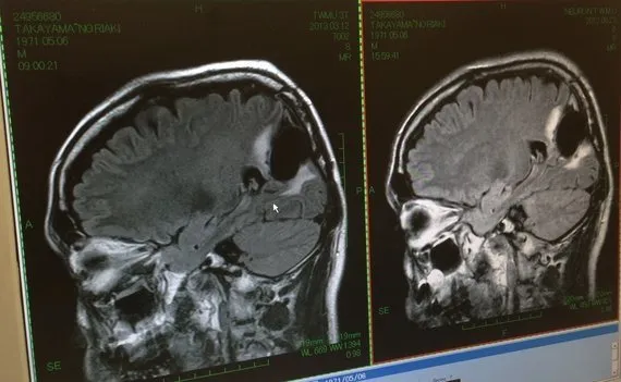 5年生存率25 と40 僕が脳腫瘍と白血病の闘病記を書く理由 ハフポスト News