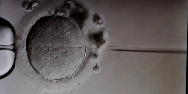 In vitro fertilization with ICSI, injecting sperm into the ovocyte (Photo by: BSIP/UIG via Getty Images)
