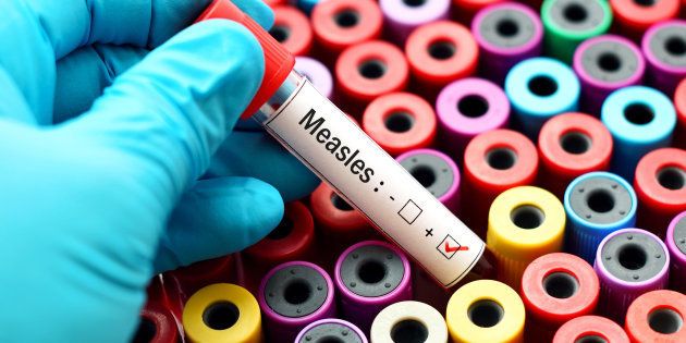 Blood sample positive with Measles virus