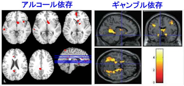 ゲームの依存性に注意 患者の脳に見られる特徴的な反応がアルコール ギャンブル依存に酷似 ハフポスト