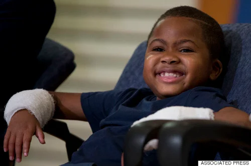 8歳の少年、世界で初めて両手の移植手術を受ける「最後まで諦めては