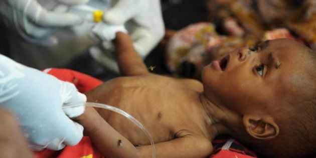 A baby is tended to in an effort to stabilize him after he was admitted to a local hospital suffering from acute malnutrition on August 16, 2011. The UN warned recently that a cholera epidemic in Somalia, which has claimed at least 181 lives in one Mogadishu hospital this year, could quickly spread as thousands flee famine in the south. The massive influx of people into Mogadishu and the rising number of cases of acute watery diarrhea in crowded urban areas places malnourished children at grave threat from cholera, which is a deadly and contagious disease,' UNICEF spokeswoman Marixie Mercado said. AFP PHOTO/ROBERTO SCHMIDT (Photo credit should read ROBERTO SCHMIDT/AFP/Getty Images)