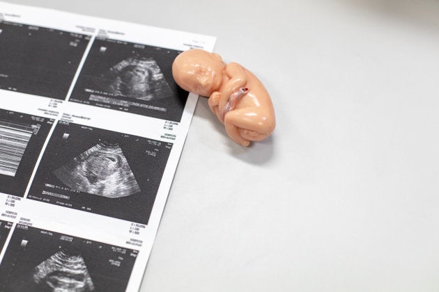 Ultrasound of baby in pregnant woman, Doctor reading test results of pregnant woman by ultrasound.