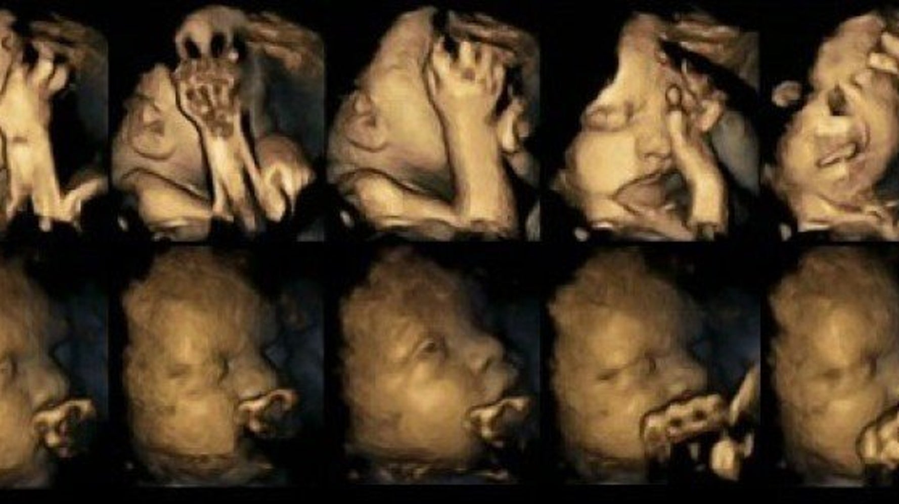 妊娠中にタバコを吸うと 胎内の赤ちゃんの動きが変わる 研究結果 ハフポスト News