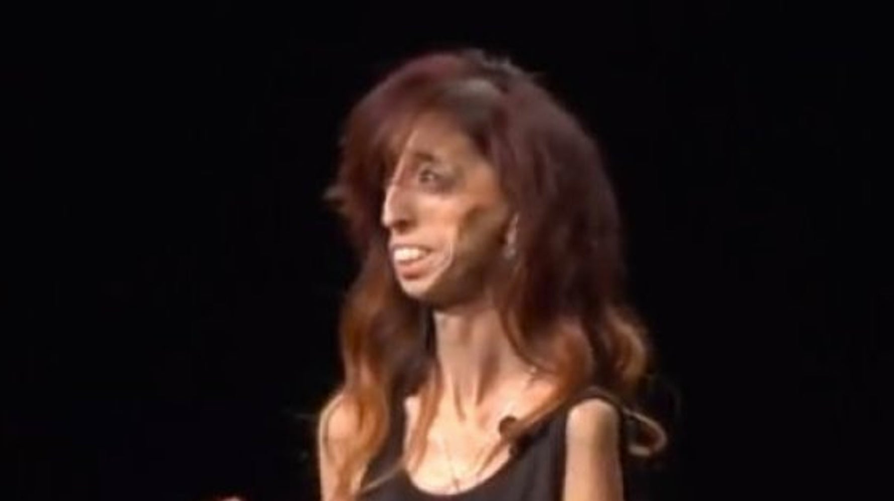 リジー ベラスケス 世界一醜い と呼ばれた女性の美しい話 ハフポスト News