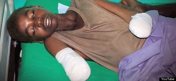 3dプリンタでつくる100ドルの義手 スーダン内戦の肢切断患者の希望に ハフポスト