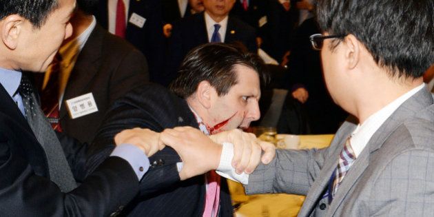 SEOUL, SOUTH KOREA - MARCH 05: (SOUTH KOREA OUT) In this handout image provided by Munhwa Ilbo newspaper, U.S. Ambassador to South Korea Mark Lippert is seen right after getting attacked on March 5, 2015 in Seoul, South Korea. Ambassador Lippert was attacked with a razor blade by a man at a venue where he was going to give a lecture. The attacker who reportedly identified himself as a representative for a watchdog organization of the disputed island Dokdo/Takeshima, was arrested immediately on site. (Photo by Chung Ha-Jong/Munhwa Ilbo via Getty Images)