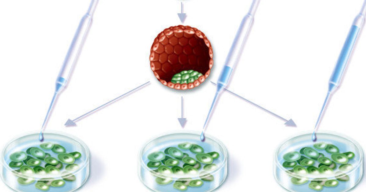 Es細胞を利用して効率よく精子を作製 不妊症の原因解明に役立つ可能性 ハフポスト News
