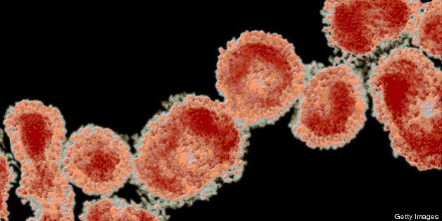 Corona Virus, showing its halo or crown-like (corona) appearance. The coronavirus is the pathogen that causes SARS or sudden acute respiratory syndrome. TEM X60,000