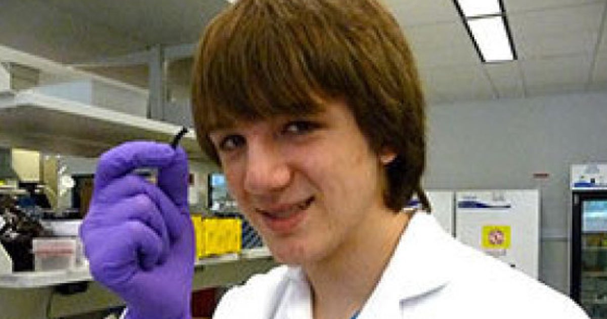 15歳の少年 膵臓がん発見の画期的方法を開発 たった5分 3セントで検査 ハフポスト 15歳の少年 膵臓がん発見の画期的方法を開発 たった5分 3セントで検査 ハフポスト