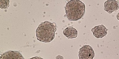 ヒトの皮膚細胞からSTAP細胞か ハーバード大研究チーム 小保方 ヒトの皮膚細胞からSTAP細胞か ハーバード大研究チーム 小保方