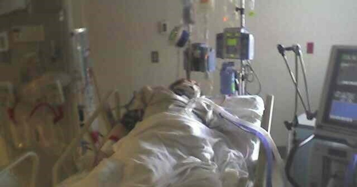I Spent 4 Weeks Near Death In The ICU. Here's What I Learned Struggling For  My Life.