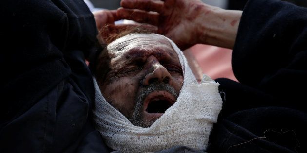 An injured man arrives outside the hospital after a blast in Kabul, Afghanistan January 27, 2018.