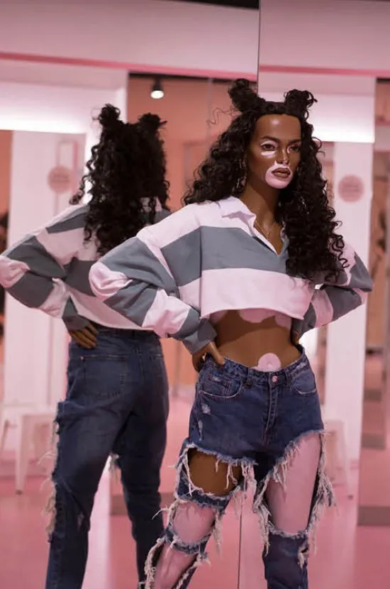 Missguided Created Mannequins With Vitiligo, Stretch Marks, and