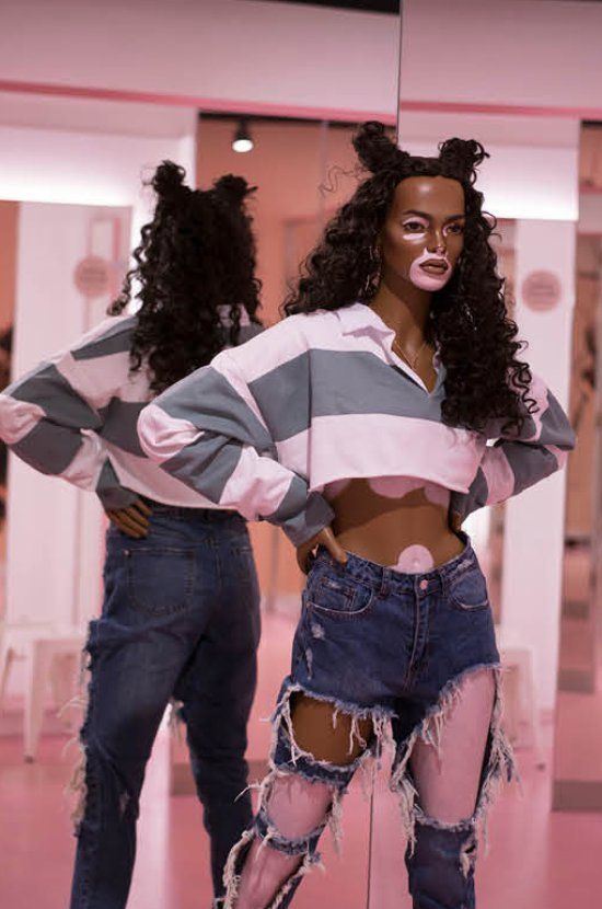 Primark praised for featuring model with vitiligo in fashion campaigns, The Independent