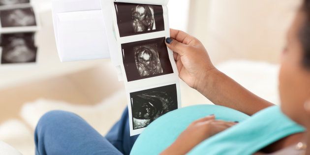 Pregnant woman sitting on the couch in the living room and looking at her ultrasound scan of the fetus.Similar images preview: