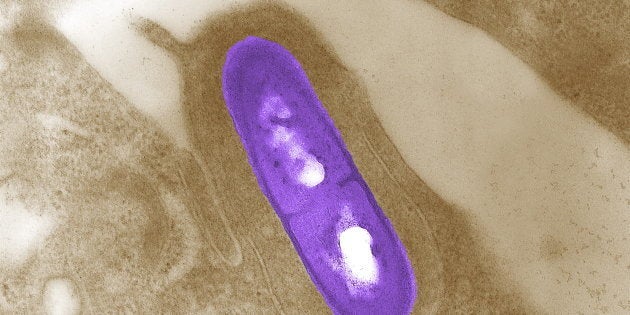 An electron micrograph of a Listeria bacterium in tissue is seen in a 2002 image from the Centers for Disease Control and Prevention (CDC).