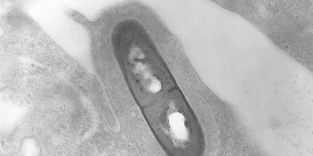 This is a transmission electron micrograph (TEM) of a Listeria sp bacterium in a tissue sample, 2002. Listeria monocytogenes is the infectious agent responsible for the food borne illness listeriosis.