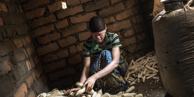 Dorothy Mausen, a 22-year-old Malawian albino woman, working at her home, in the traditional authority area of Nkole, Machinga district, on April 17, 2015.