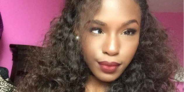 I'm Cross-Eyed And I Love It' -- Make-Up Artist Shares A Powerful Message  Of Self-Love