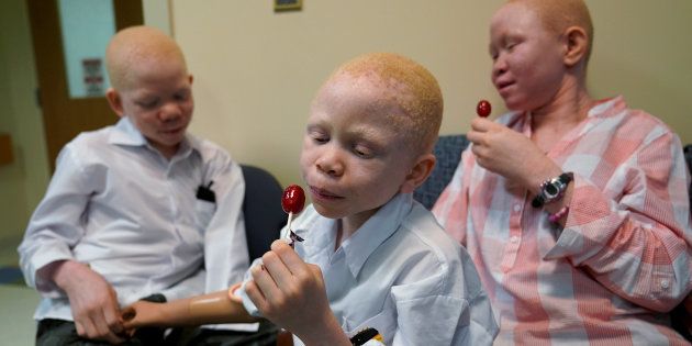 Mwigulu Magesaa (L) (14), Baraka Lusambo, (C) (7) and Pendo Noni (R) (16) wait in the lobby during prosthetic arm fittings at the Shriners Hospital in Philadelphia, Pennsylvania, U.S., May 30, 2017. All three are Tanzanians with albinism who had body parts chopped off in witchcraft-driven attacks.