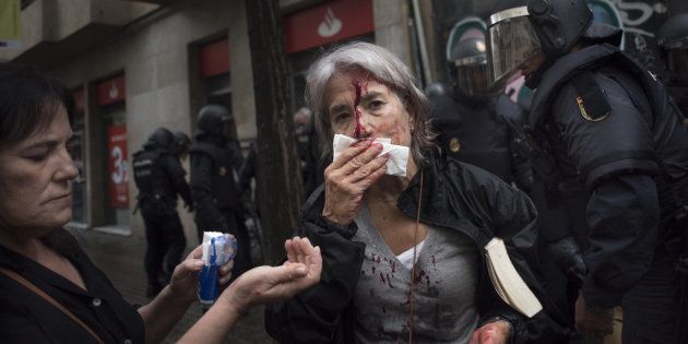 A woman tends to her injuries in front of riot police near a school being used as a polling station for the banned referendum, in Barcelona, Spain, on Sunday, Oct. 1, 2017. Spanish police moved in to shut down some polling stations as voting began Sunday in Catalonias illegal referendum on independence. Photographer: Geraldine Hope Ghelli/Bloomberg via Getty Images