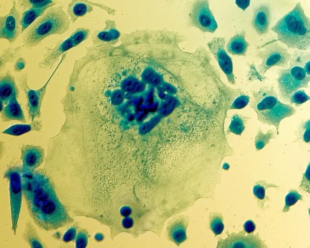 PC-3 human prostate cancer cells.
