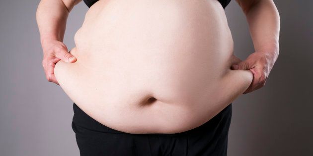 Obesity in a female body.