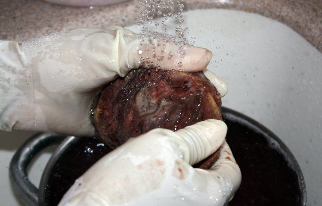 This is a human placenta being washed before it is steamed.