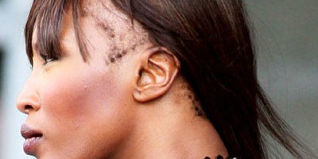 5 Reasons Why Your Hairline Might Be Receding | HuffPost UK