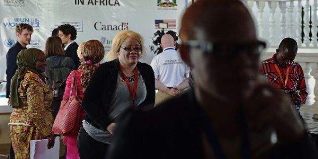 Delegates at a regional conference on albinism organised by the United Nations (UN) to discuss potential measures and legislation to protect people with albinism in Africa from discrimination and superstitious attacks, in Dar es Salaam in June 2016. In Tanzania, as well as in Malawi and some other parts of sub-Saharan Africa, albino body parts are sought after for potions and charms thought to bring luck and wealth, and many fall victim to murderers who dismember their bodies to supply this grisly black market trade. Canadian charity Under The Same Sun (UTSS) has documented 161 attacks on people with albinism in Tanzania in recent years, including 76 murders, more than anywhere else in Africa.