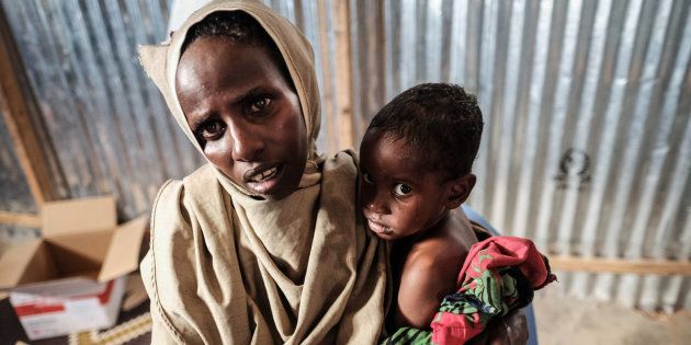 The centre is busy with mothers queuing to receive the peanut paste, and children being weighed and screened. (Photo by Maciej Moskwa/NurPhoto via Getty Images)