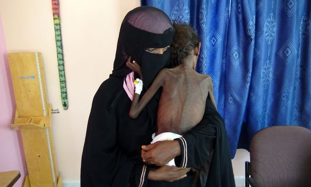 Υεμένη: Γονείς πουλάνε κορίτσια τριών ετών για λίγο