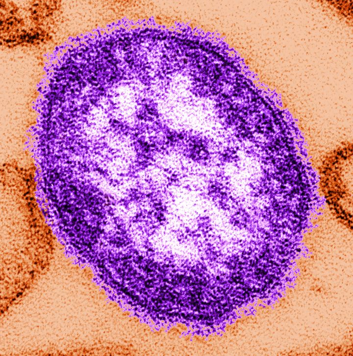 Measles is considered one of the most infectious diseases known. The virus, pictured, is spread through the air when someone infected coughs or sneezes.