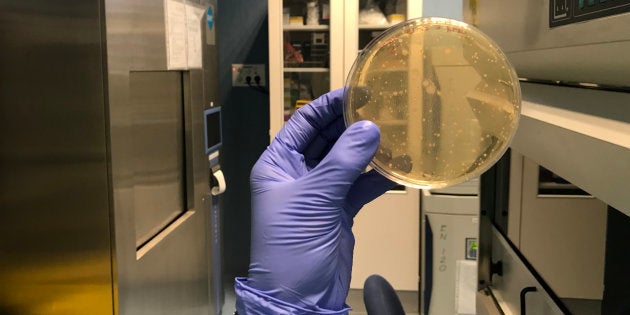 En el Simulador Gastrointestinal Dinámico del CIAL estudian las bacterías del yogur.