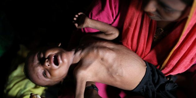Un pequeño y desnutrido rohingya llora en brazos de su madre en el campo de refugiados de Balukhali,...