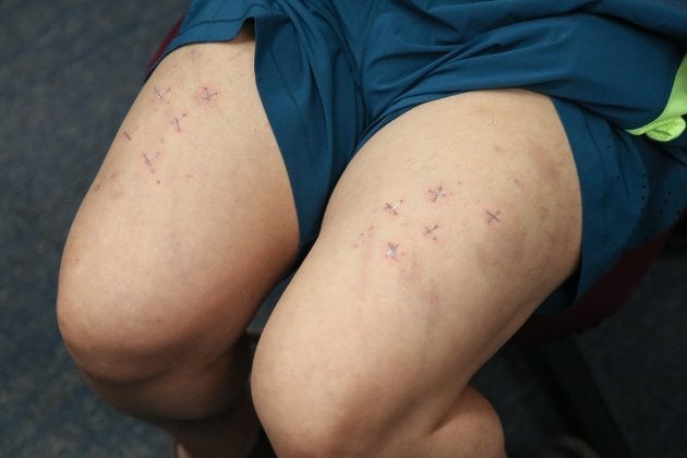 El activista, mostrando sus heridas.