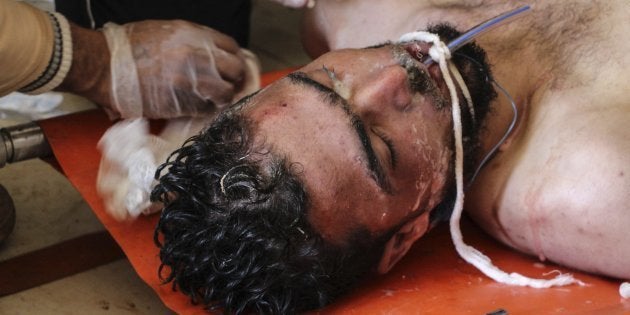 Un hombre recibe tratamiento médico tras el supuesto ataque con armas químicas en Jan Sheijun (Idleb).